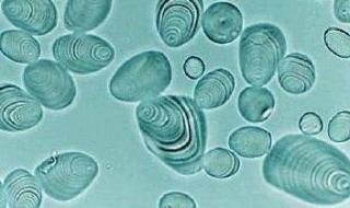 直链淀粉和支链淀粉 直链淀粉和支链淀粉